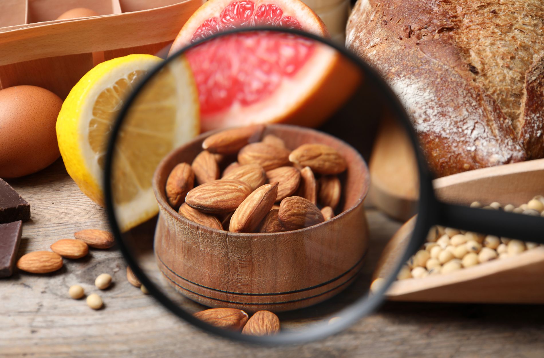 food allergy